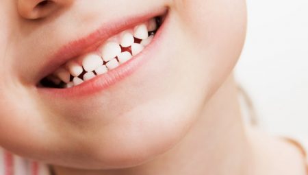 Ağzında yemek tutan çocuklarda dişler daha kolay çürüyor
