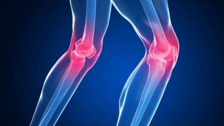 Diz kireçlenmesi yaşıyorsanız…