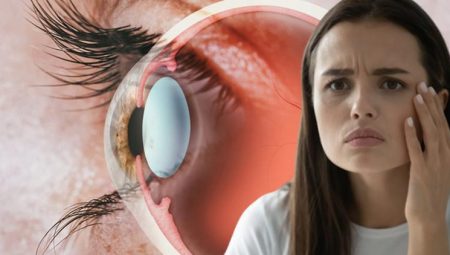 Bahar aylarında artıyor: Kirpikleriniz dökülüyorsa dikkat!