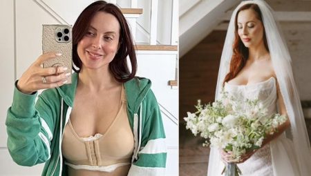 Gelinliğin dekoltesi yüzünden düğünü zehir olmuştu… Dayanamayıp göğüslerini küçülttürdü