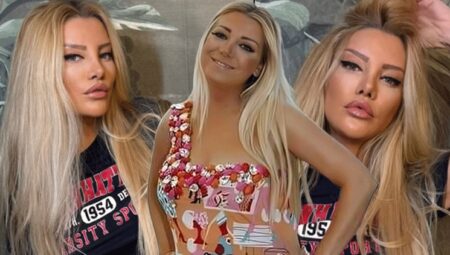 Gülşah Saraçoğlu’nu sevenleri tanımakta zorlandı! Estetik operasyonundan 13 gün sonra makyajlı birinci poz