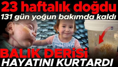 Prematüre doğdu, 131 gün ağır bakımda kaldı. Hayatını balık derisi tedavisi kurtardı | ‘Ona küçük denizkızım diyorum’